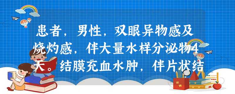 患者,男性,双眼异物感及烧灼感,伴大量水样分泌物4天。结膜充血水肿,伴片状结膜下出血,角膜上皮点 患者,男性,双眼异物感及烧灼感,伴大量水样分泌物4天。结膜充血水肿,伴片状结膜下出血,角膜上皮点