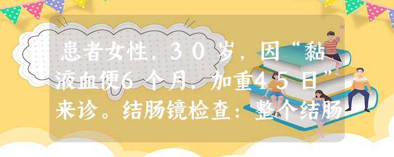 患者女性,30岁,因“黏液血便6个月,加重45日”来诊。结肠镜检查:整个结肠充血、水肿、脆性增加、出血,大 患者女性,30岁,因“黏液血便6个月,加重45日”来诊。结肠镜检查:整个结肠充血、水肿、脆性增加、出血,大