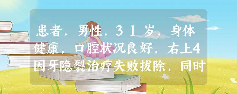 患者,男性,31岁,身体健康,口腔状况良好,右上4因牙隐裂治疗失败拔除,同时行形态大小相同的异体牙 患者,男性,31岁,身体健康,口腔状况良好,右上4因牙隐裂治疗失败拔除,同时行形态大小相同的异体牙