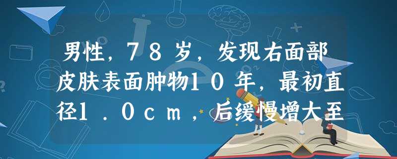 男性,78岁,发现右面部皮肤表面肿物10年,最初直径1.0cm,后缓慢增大至2.0cm,质硬,表面呈蜡状,边缘 男性,78岁,发现右面部皮肤表面肿物10年,最初直径1.0cm,后缓慢增大至2.0cm,质硬,表面呈蜡状,边缘