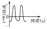 神经电位的测量装置如下图所示,其中箭头表示施加适宜刺激,阴影表示兴奋区域。用记录仪记录A、B两电极之间的电位差,结果如下侧曲线图。若将记录仪的A、B 神经电位的测量装置如下图所示,其中箭头表示施加适宜刺激,阴影表示兴奋区域。用记录仪记录A、B两电极之间的电位差,结果如下侧曲线图。若将记录仪的A、B
