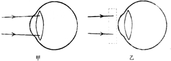 近视眼只能看清近处的物体,看不清远处的物体.①请在图甲中完成近视眼看远处物件的大致光路图;②在图乙中的虚线框里画出矫正近视眼所需配戴眼镜的种类;③完成矫正后人眼 魔方格