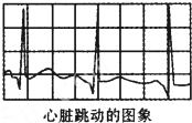 如图所示图线是某人的心电图,方格纸每个小方格的宽度是0.5cm,心电图记录仪拖动方格纸的速度是1.8cm/s.下列说法正确的是A.通过心电图可知,心脏跳 魔方格