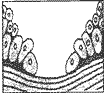 阅读理解。 When we have small cuts in the skin (皮肤), something strange may 阅读理解。 When we have small cuts in the skin (皮肤), something strange may
