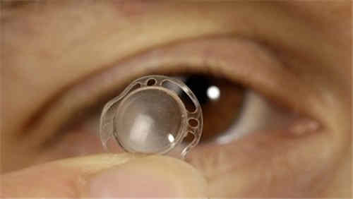 人工角膜是什么